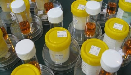化妝品FDA測(cè)試抗菌效果-防腐劑(USP 51)測(cè)試